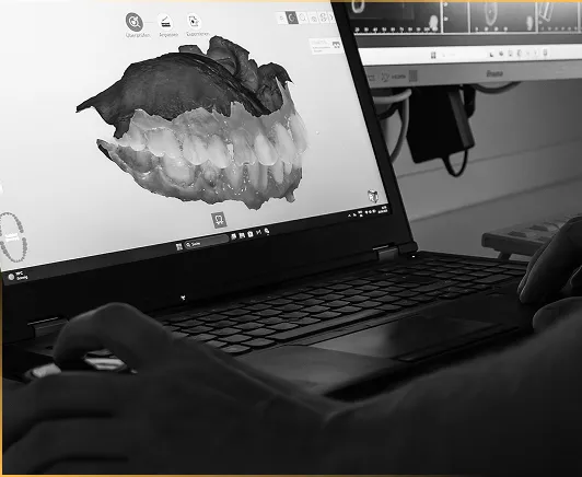 Schwarz-weiß-Aufnahme eines Zahnarztes, der auf einem Laptop ein digitales 3D-Modell eines Gebisses analysiert