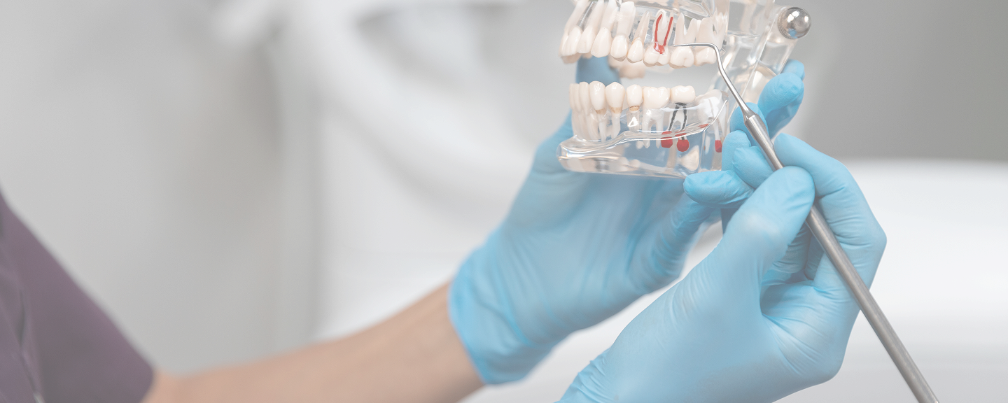 Zahnarzt mit blauen Handschuhen demonstriert an einem anatomischen Zahnmodell die Zahn- und Wurzelstruktur mit einem Instrument