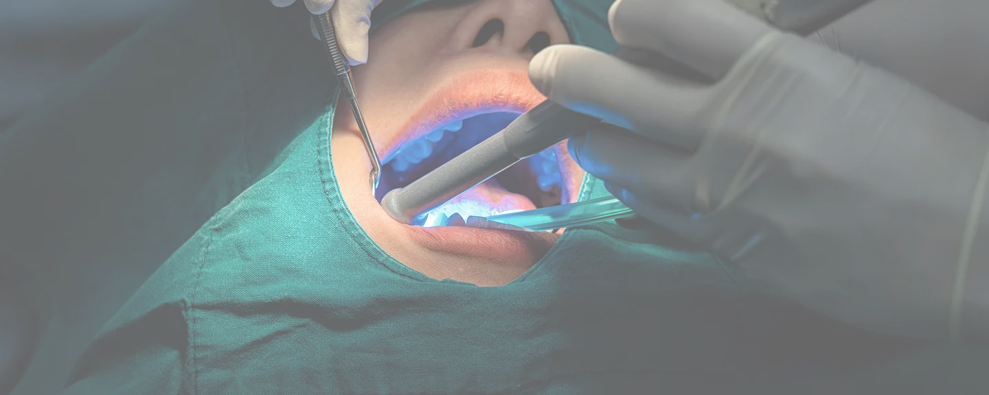 Zahnärztliche Behandlung unter OP-Bedingungen mit blauem Polymerisationslicht und Absaugung im Mundraum eines Patienten