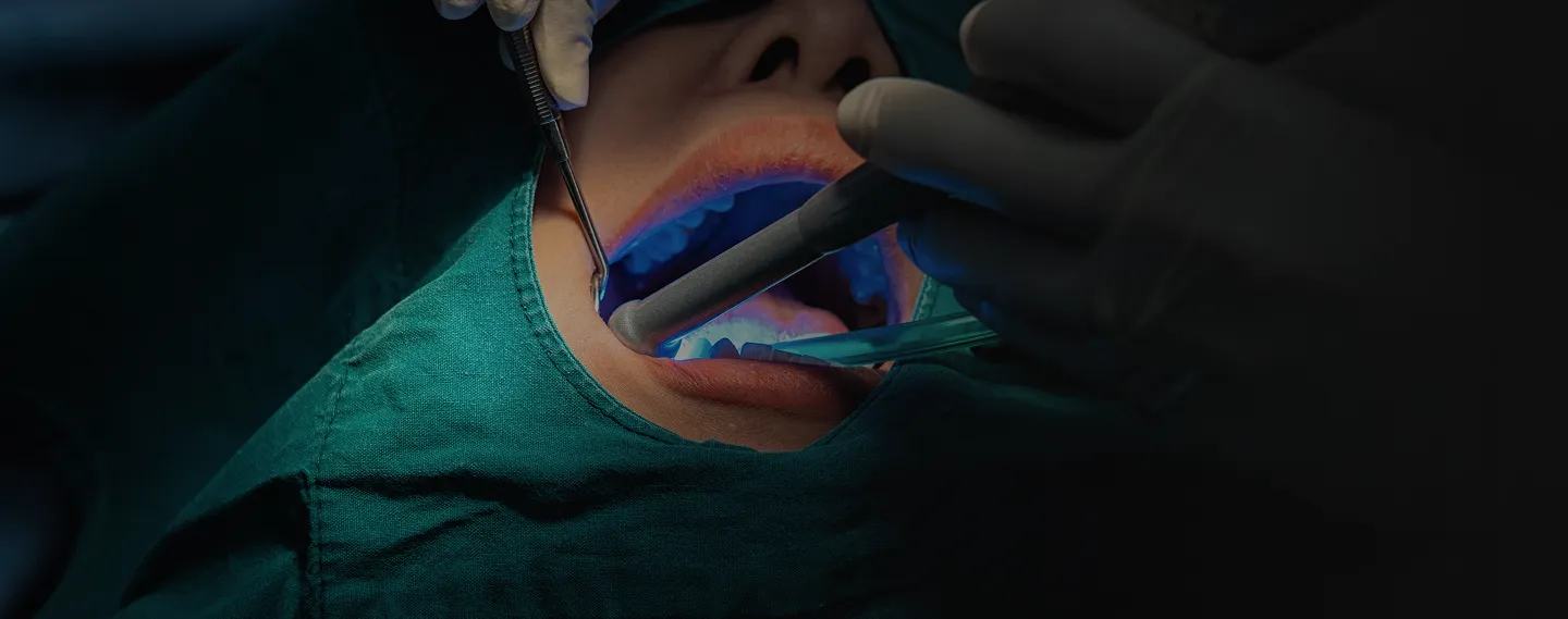 Zahnärztliche Behandlung unter OP-Bedingungen mit blauem Polymerisationslicht und Absaugung im Mundraum eines Patienten