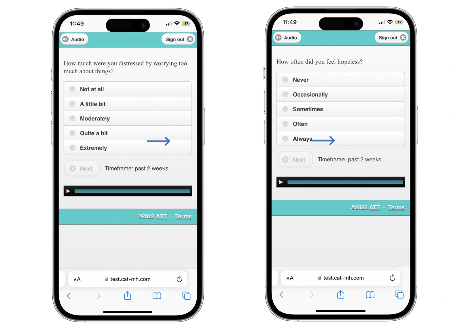 Two smartphones displaying mental health survey questions: left screen asks about distress from worrying with options from not at all to extremely; right screen asks about feeling hopeless with options from never to always.