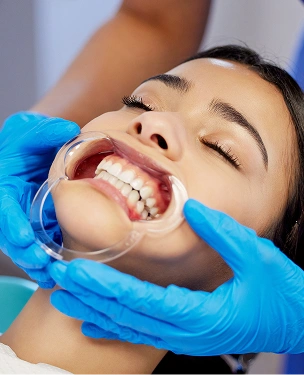 Exposure of Impacted Canines