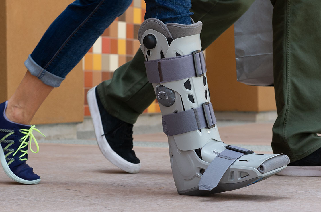 Women wearing Aircast Airselect walking boot on right foot.