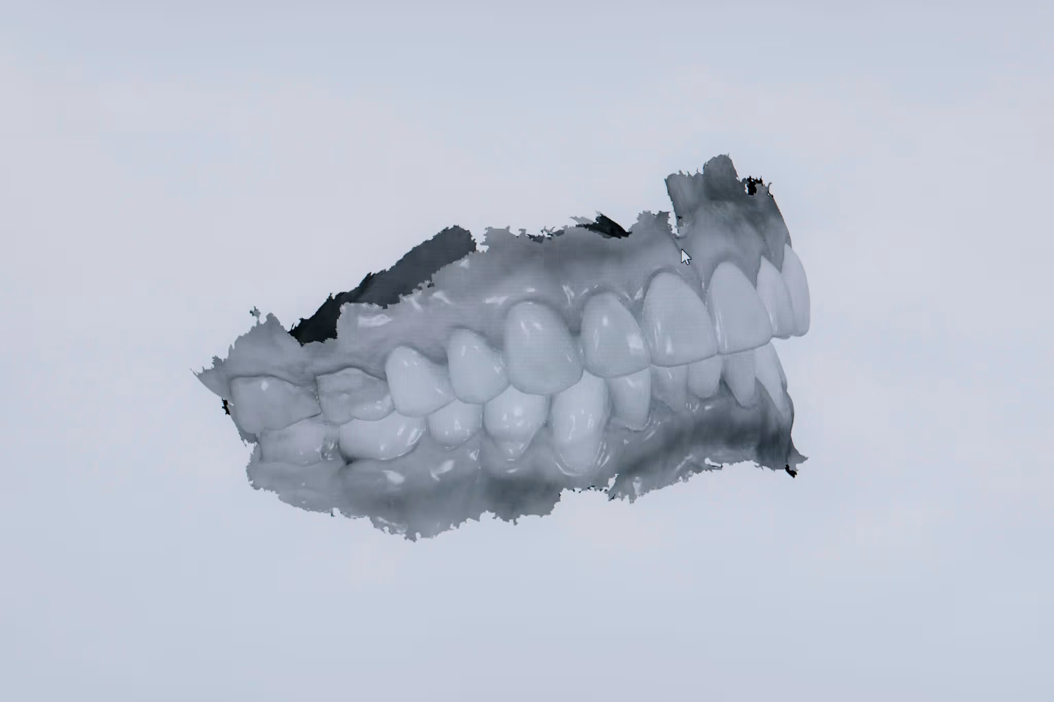 modello tridimensionale e virtuale dei denti