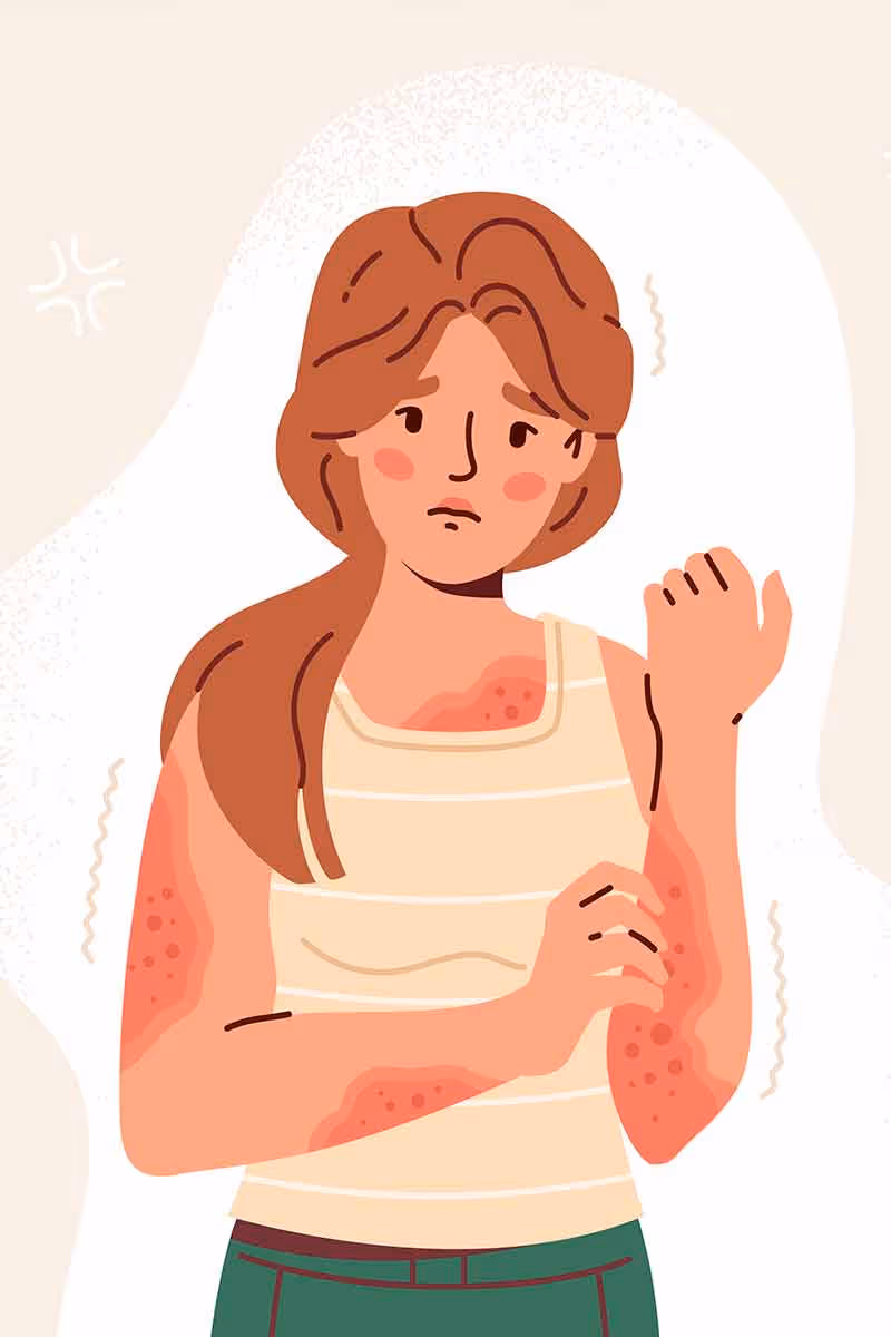 Trichotillomania and Dermatillomania