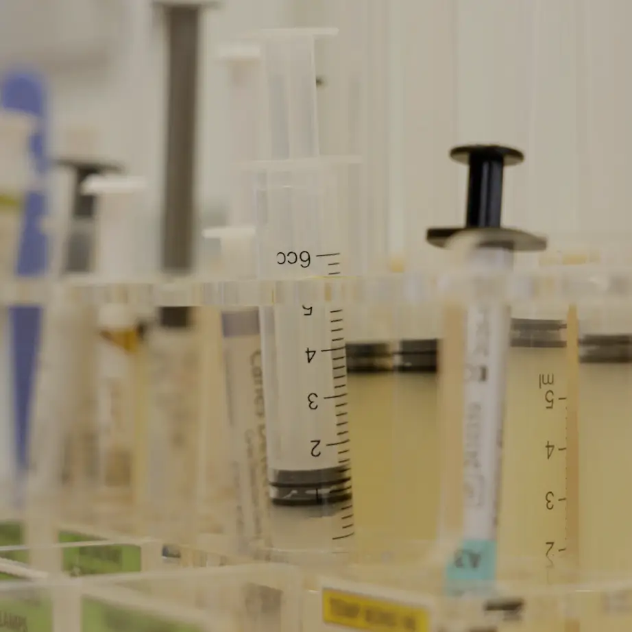 Root Canal Treatment