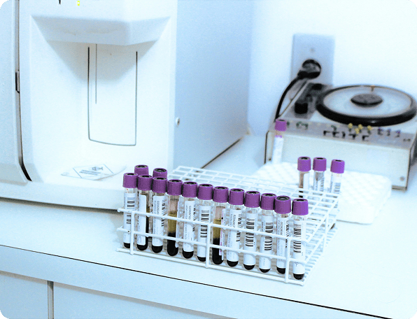 Epruvete sa uzorcima krvi u laboratoriji na analizi