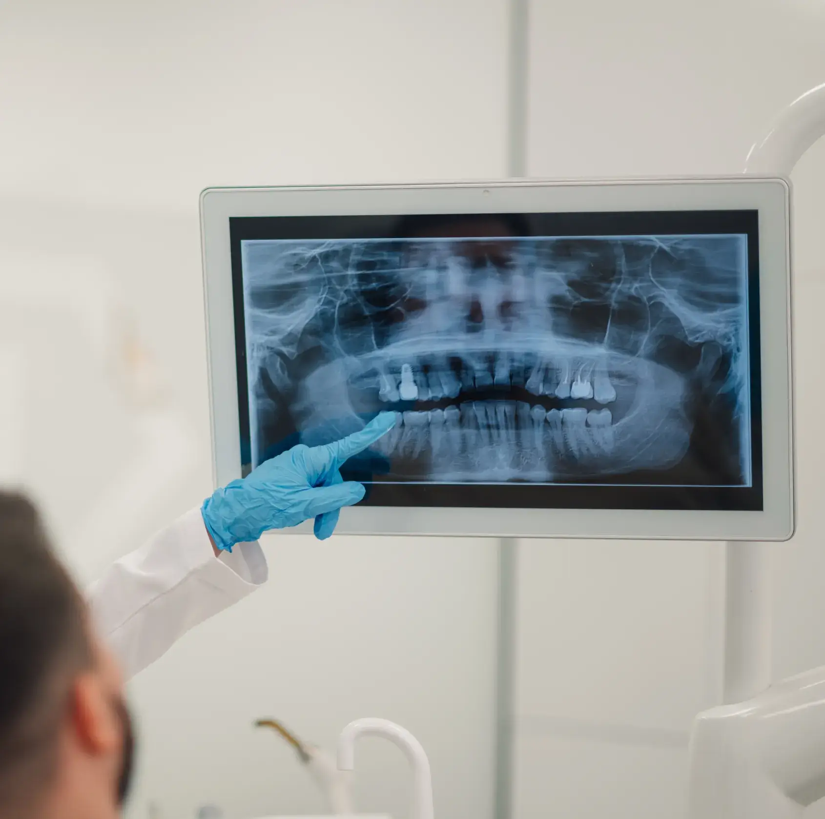 Dentist wearing blue gloves pointing at a dental X-ray image on a screen.