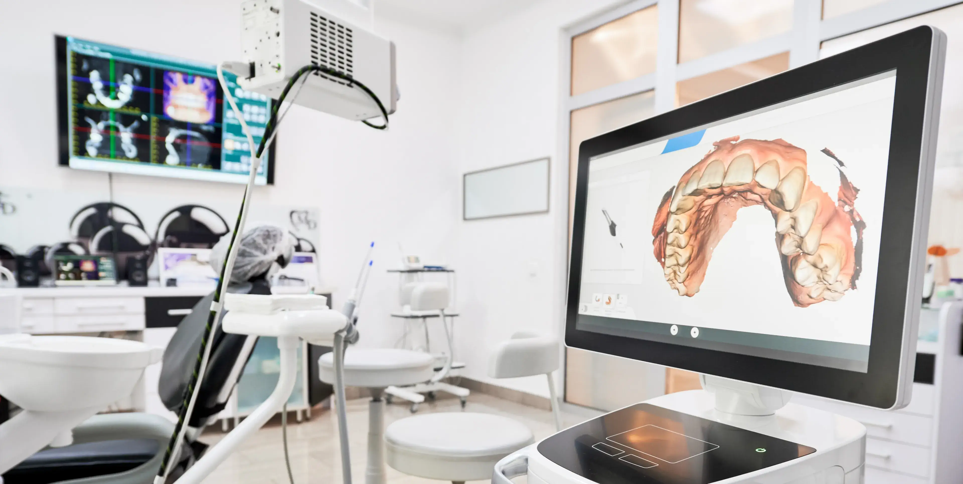 Dental office with a digital 3D model of upper teeth displayed on a computer screen next to a dental chair.