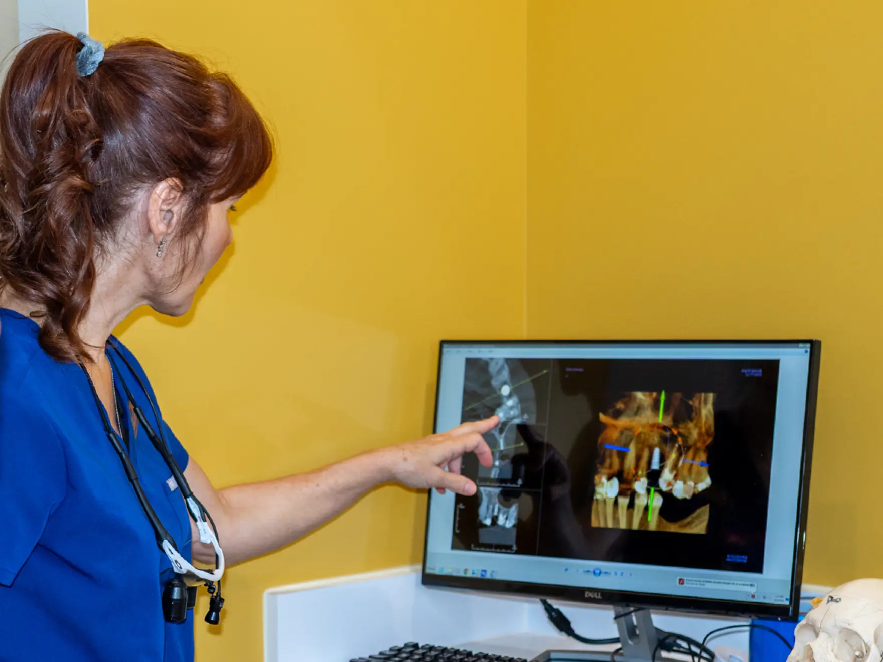 CBCT Imaging at Able Dentistry