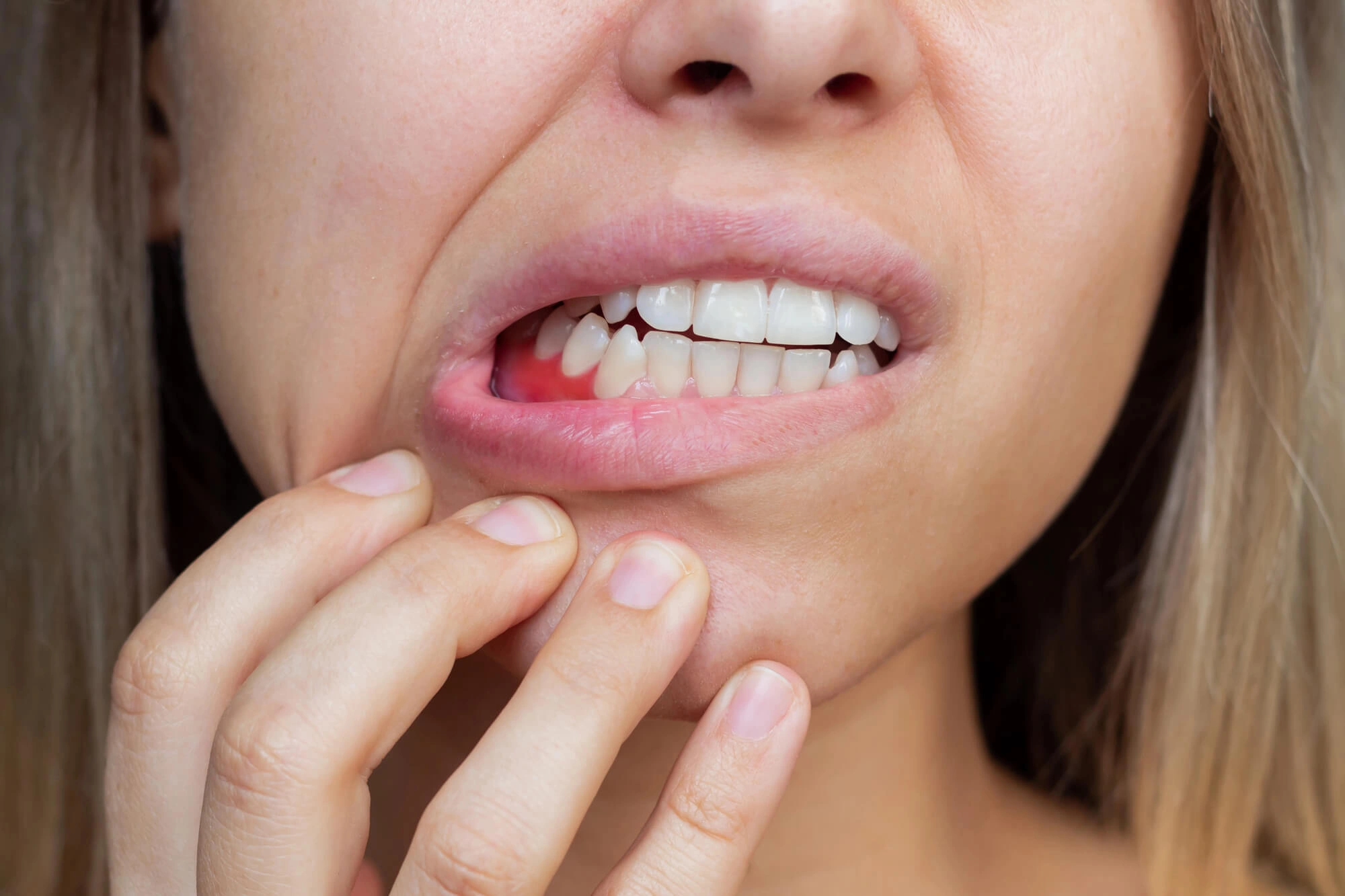 Swollen gums needs periodontist reading pa