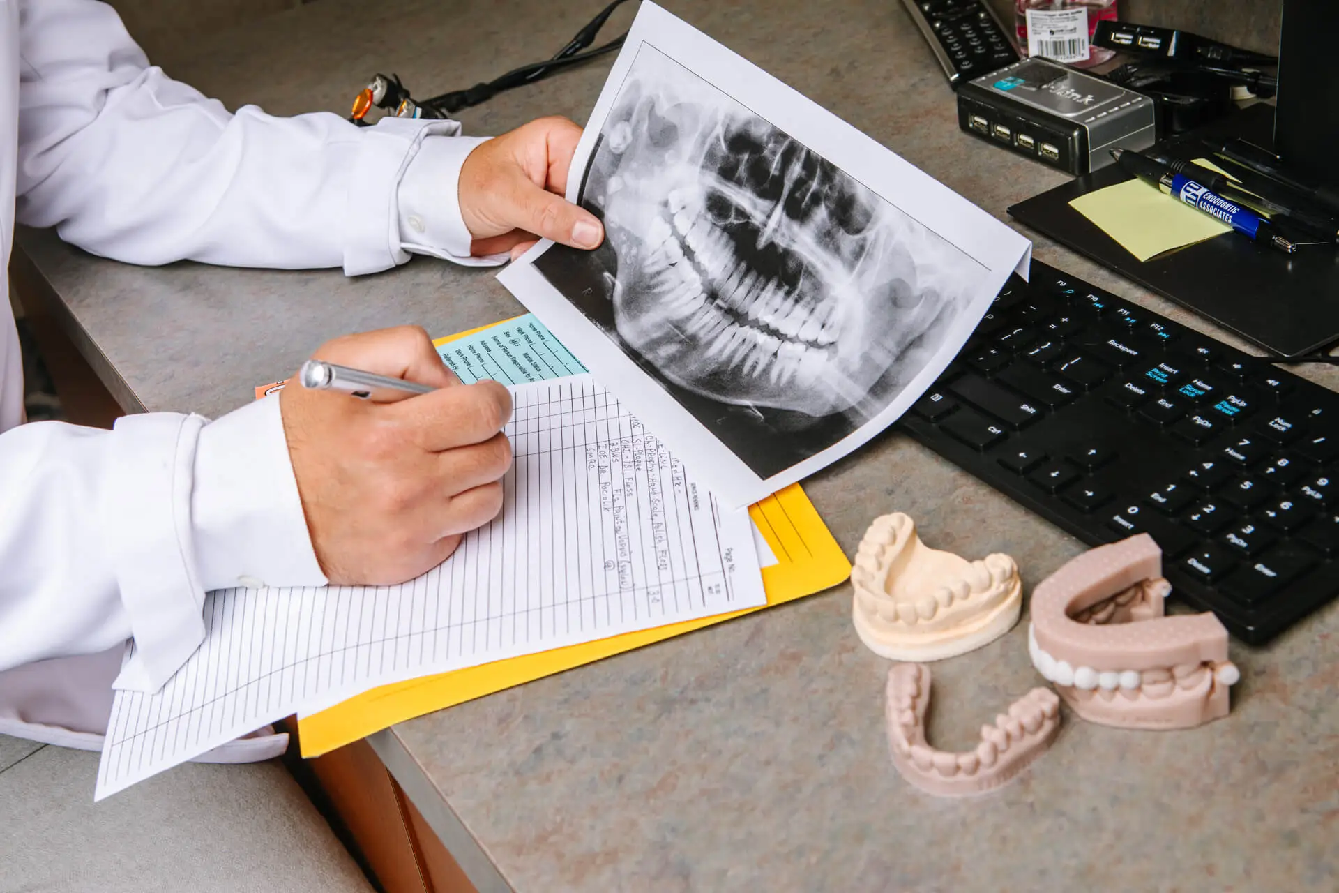 Person writing notes while holding a dental X-ray with dental molds on the desk.