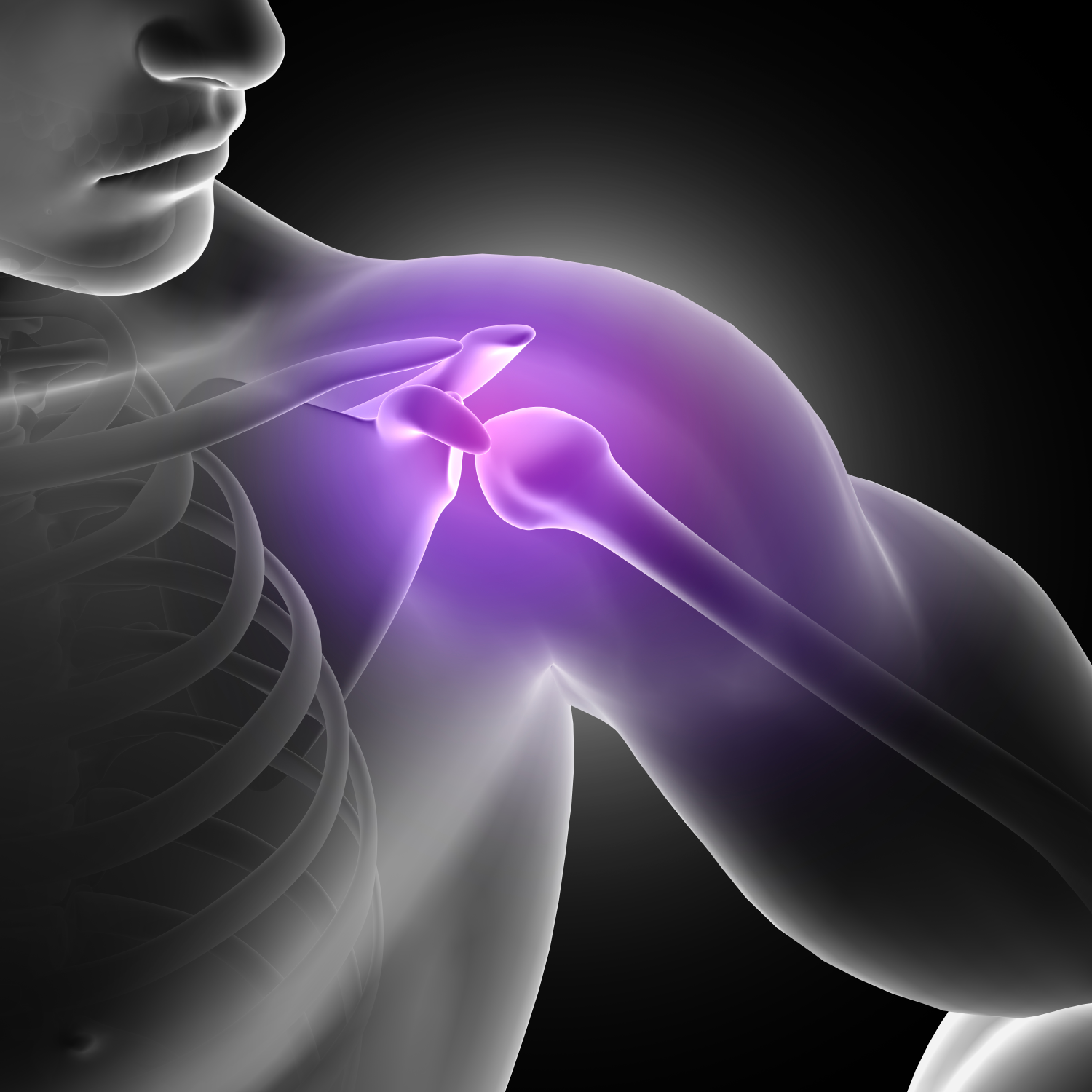 causes of shoulder pain