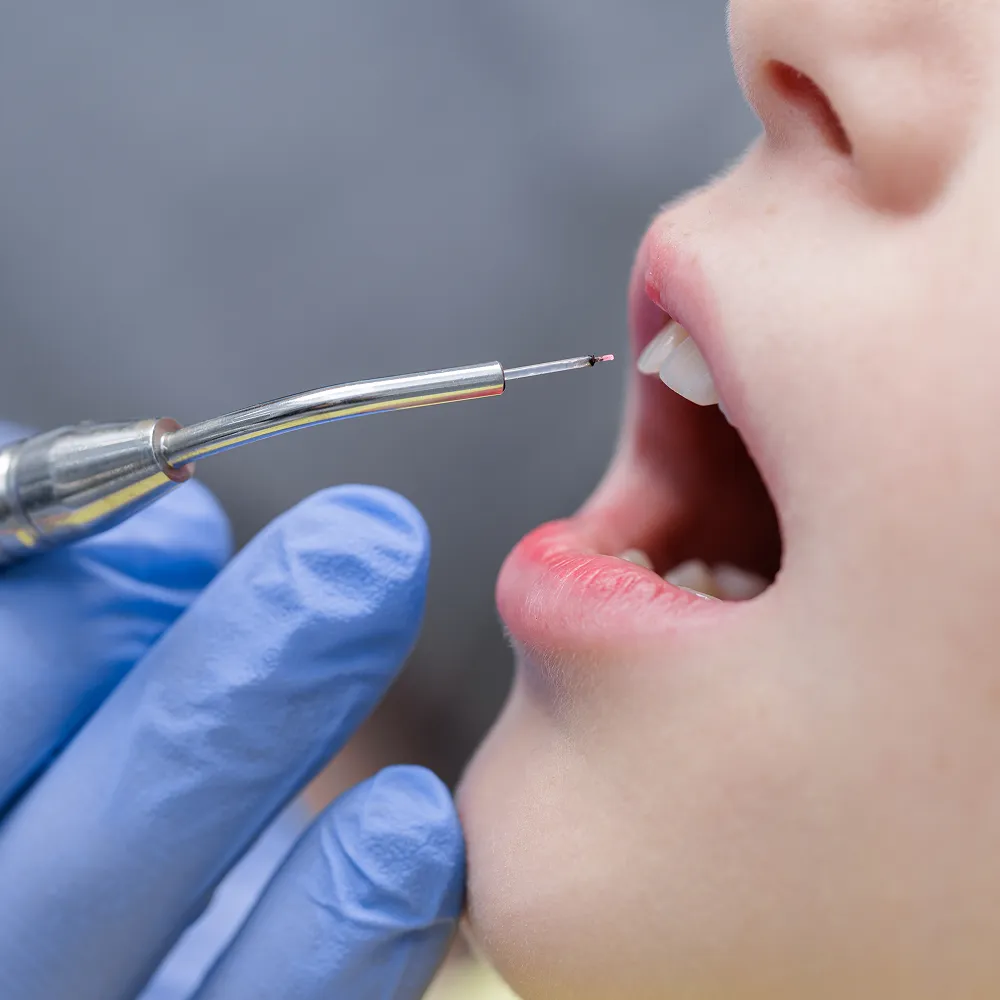 Experienced dental team providing natural-looking gum contouring with modern, comfortable care at Haven