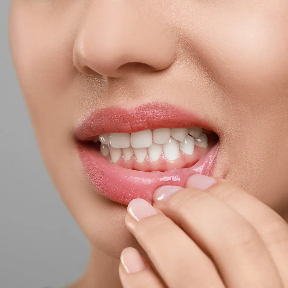 Illustration of gingivectomy to reshape and improve gum line appearance