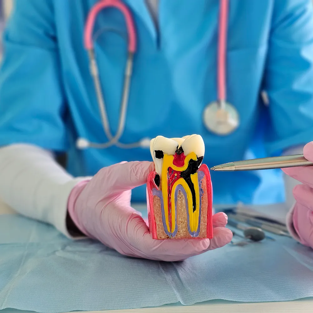 Illustration explaining how root canal therapy removes infection and preserves the natural tooth