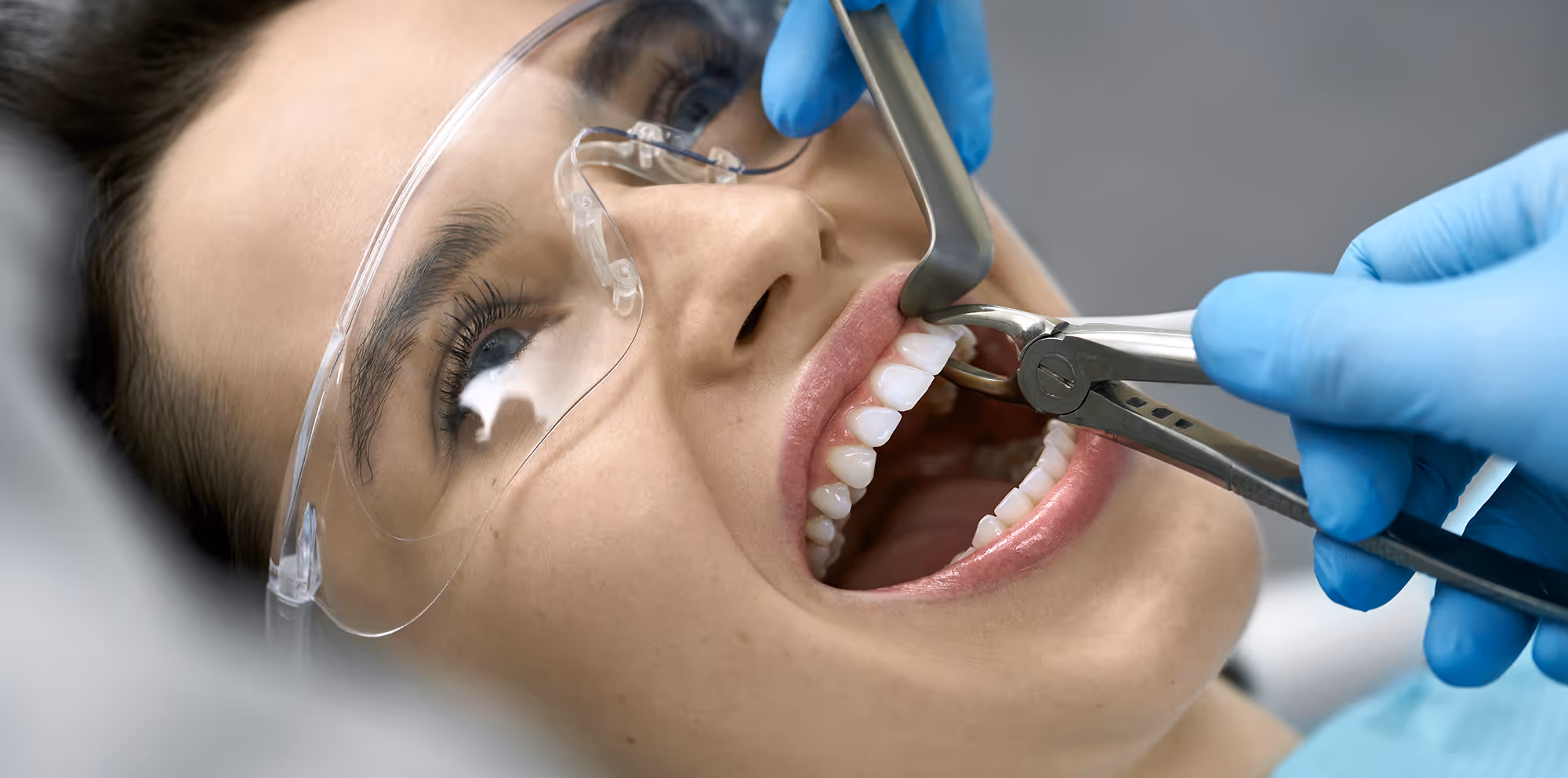 Tooth Extractions and Wisdom Teeth Removal at Haven Cosmetic Dentistry & Implant Center