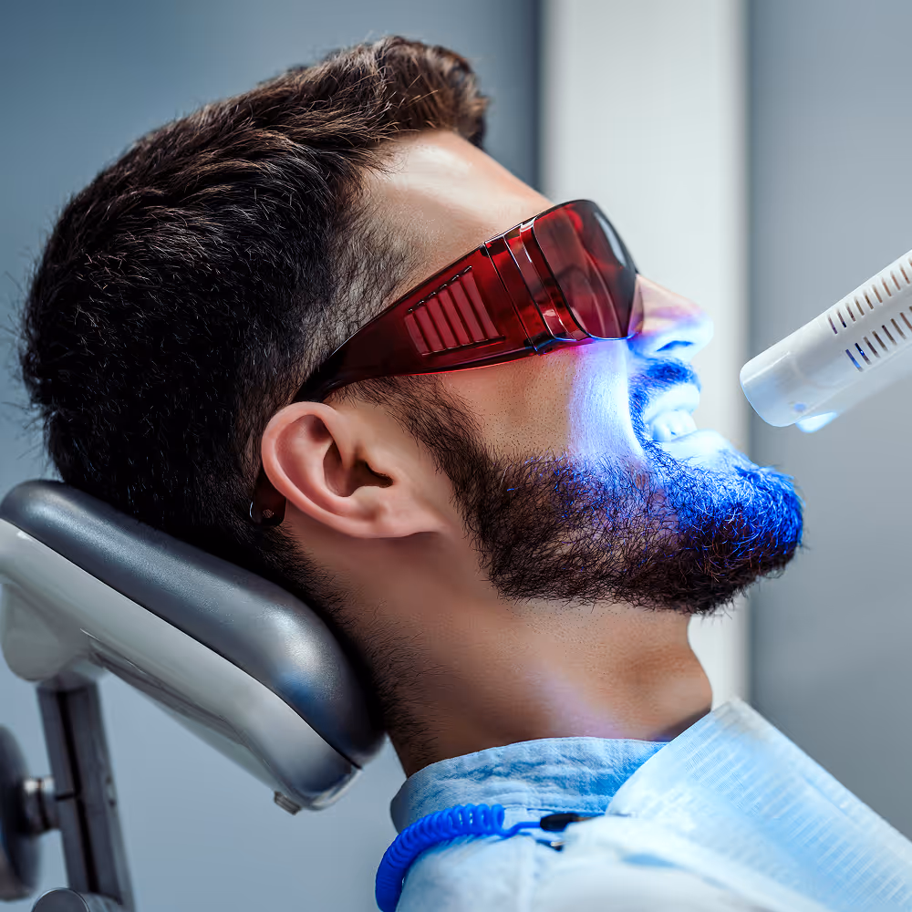 Comparison showing professional in-office whitening results versus at-home whitening kits