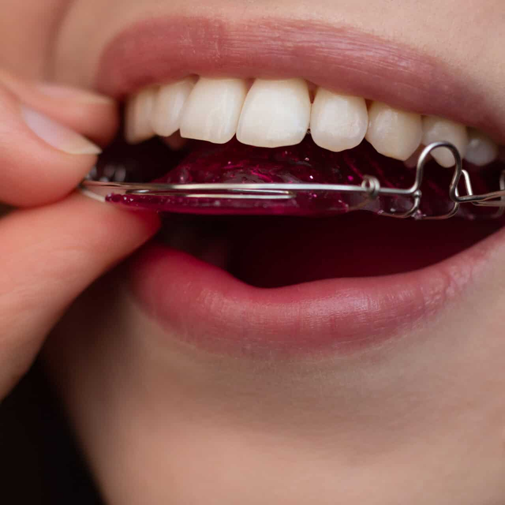 Convenient, easy-to-clean retainers designed for flexibility and everyday comfort