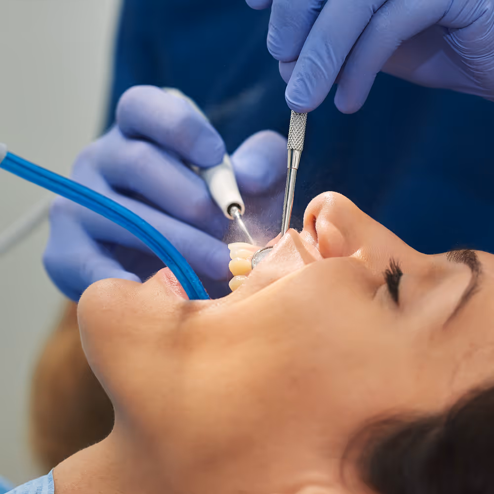Step-by-step view of a dentist cleaning and filling the tooth root during a root canal procedure