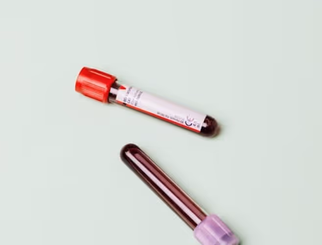 Zwei Blutprobenröhrchen, eines mit rotem Verschluss und eines mit lila Verschluss, liegen auf hellem Hintergrund.