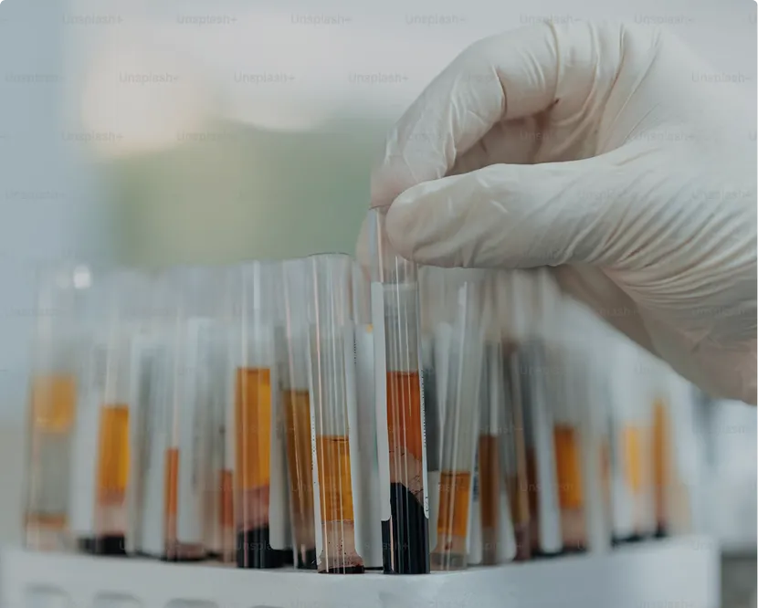A gloved hand holding a row of test tubes.
