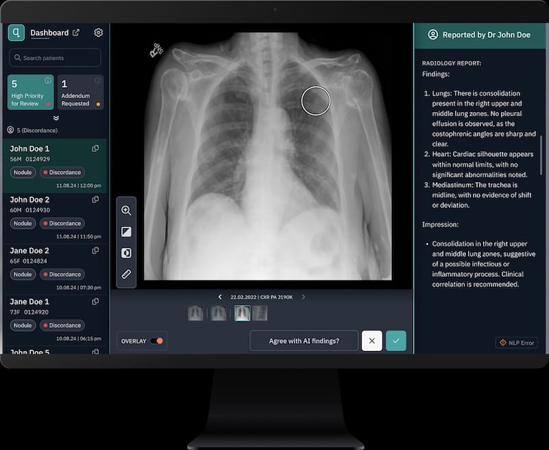 Qure.ai Screenshot
