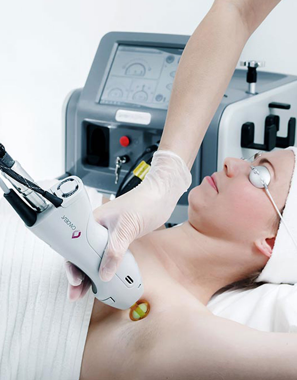 Frau liegt mit Schutzbrille auf der Behandlungsliege, während eine Fachkraft mit einem medizinischen Lasergerät die Achsel für eine Haarentfernung behandelt.