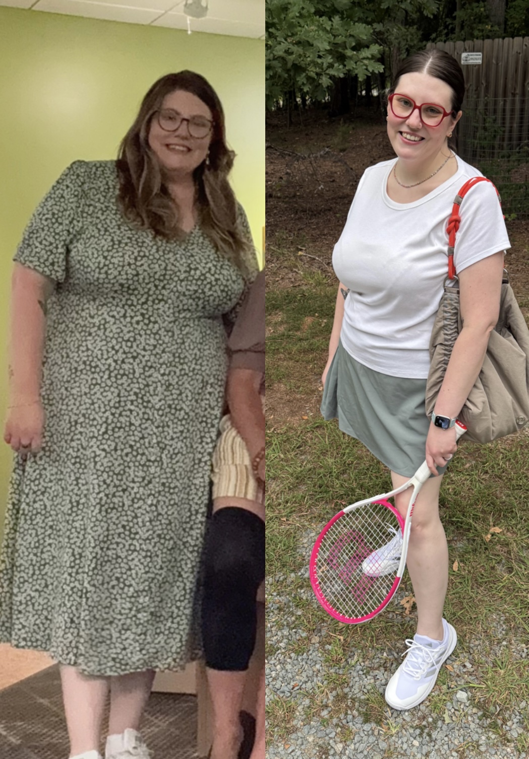 Jackie's weight loss before and after image