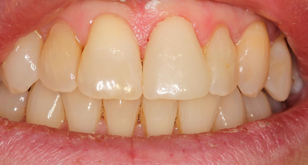 After Image