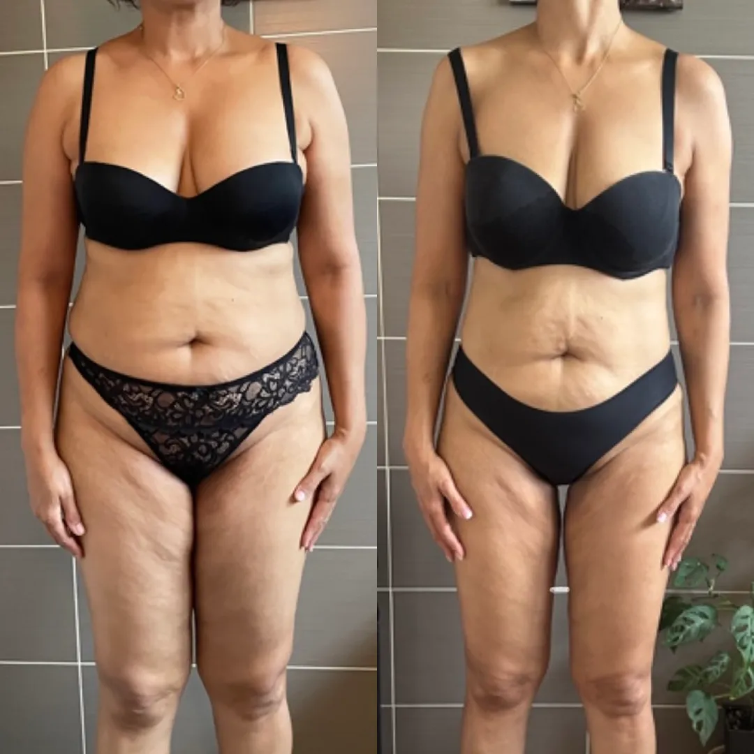 Femme de 50 ans au corps ferme et tonique.