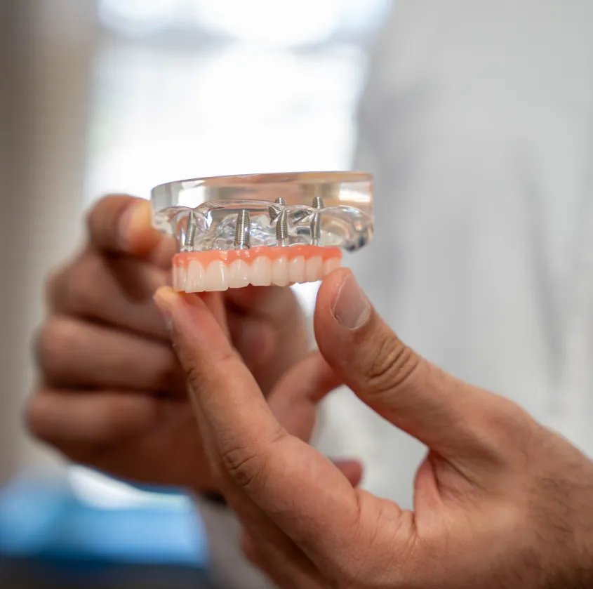 Hands holding a dental model showing teeth and implants on a transparent base.
