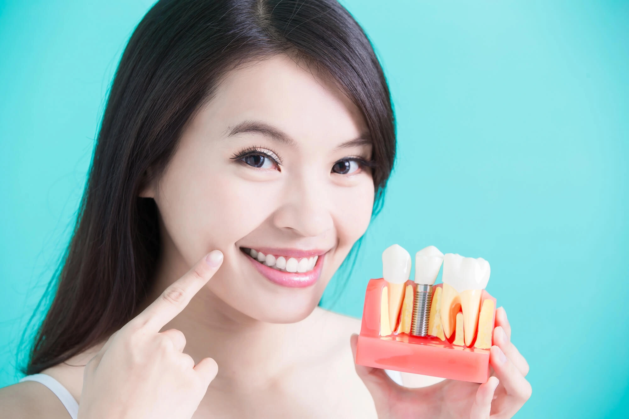Woman holding a model of dental implants west chester pa