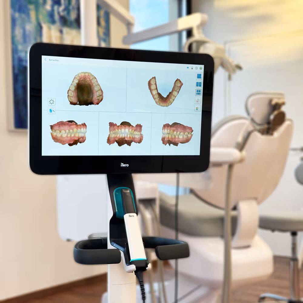 Zahnscanner iTero mit 3D-Bildern von Zähnen auf dem Bildschirm in einer Zahnarztpraxis.