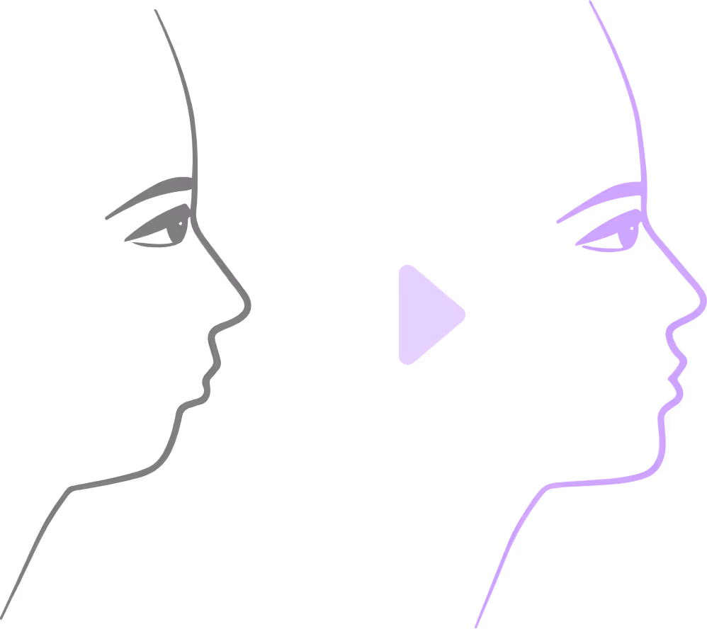 Schematische Darstellung der Verbesserung der Kieferstellung nach einer kieferorthopädisch-kieferchirurgischen Kombinationsbehandlung.