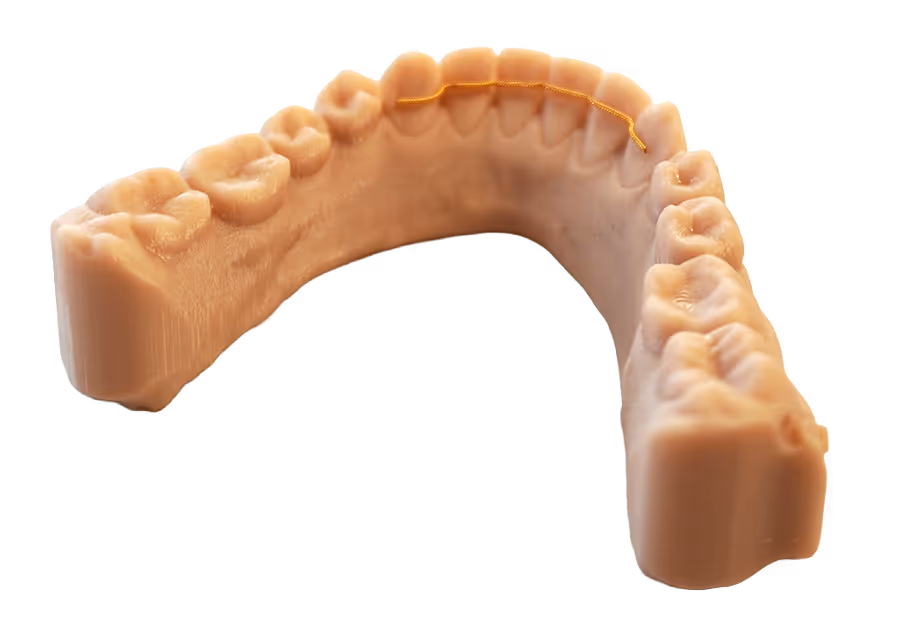 Zahnmodell des Unterkiefers mit einem dünnen goldfarbenen Retainer hinter den vorderen Zähnen.