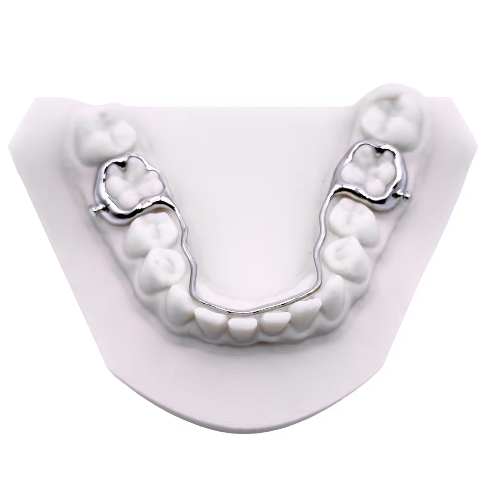 Modell eines Unterkieferzahnbogens mit einem festen Lingualbogen.