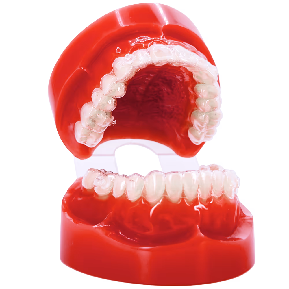 Modell eines Gebisses mit transparenten Zahnschiene.