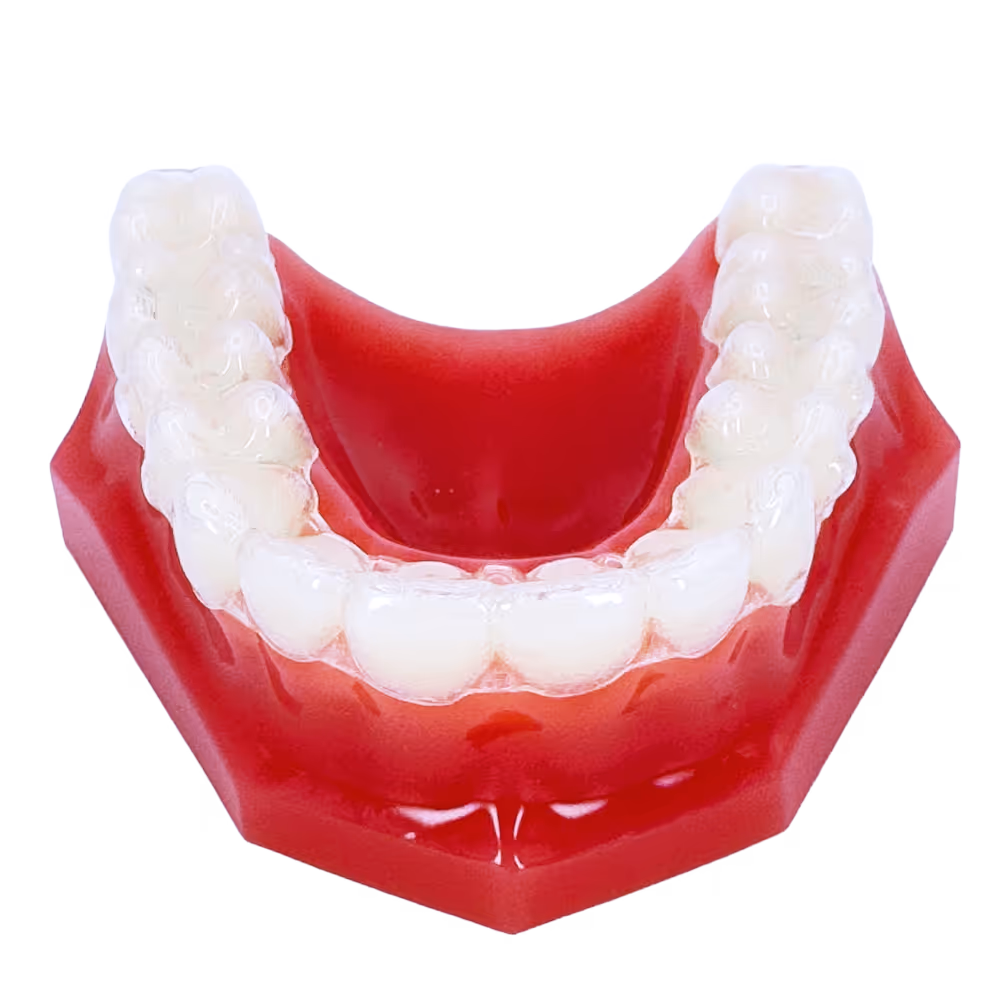 Durchsichtige Zahnschiene auf einem roten Kiefermodell.