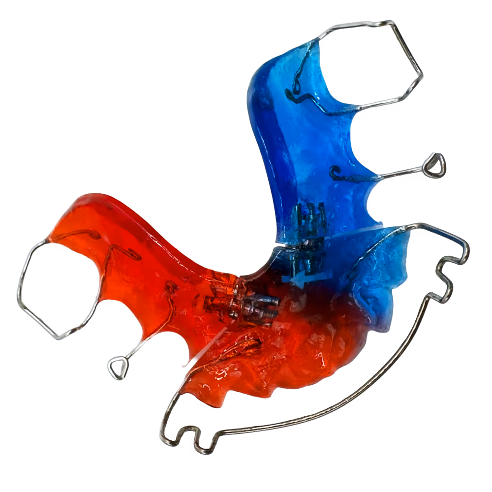 Bunte herausnehmbare Zahnspange mit roten und blauen Kunststoffteilen und Metallbügeln.