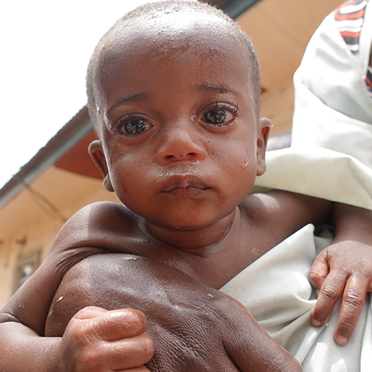 Action contre la Faim