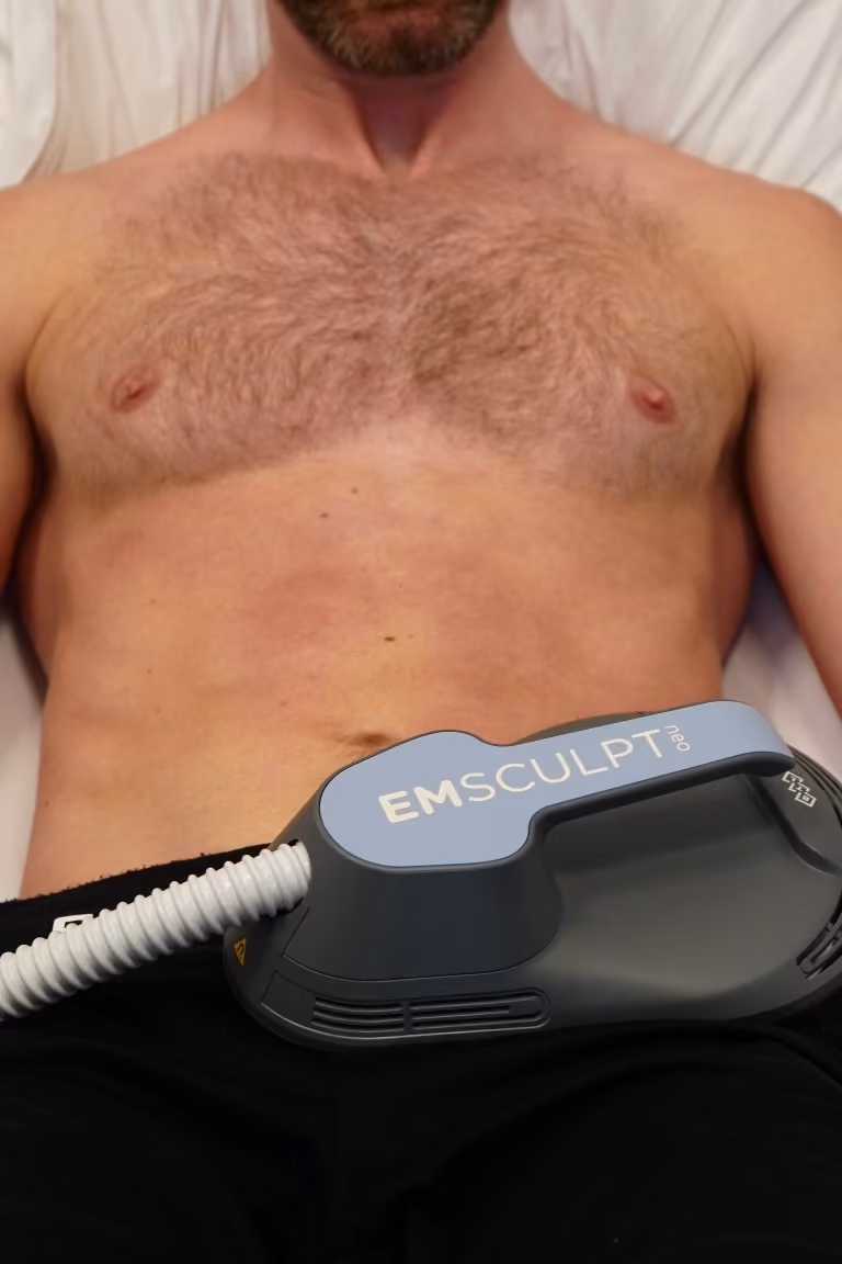 Man lying on a treatment bed with an Emsculpt Neo applicator on his lower abdomen.