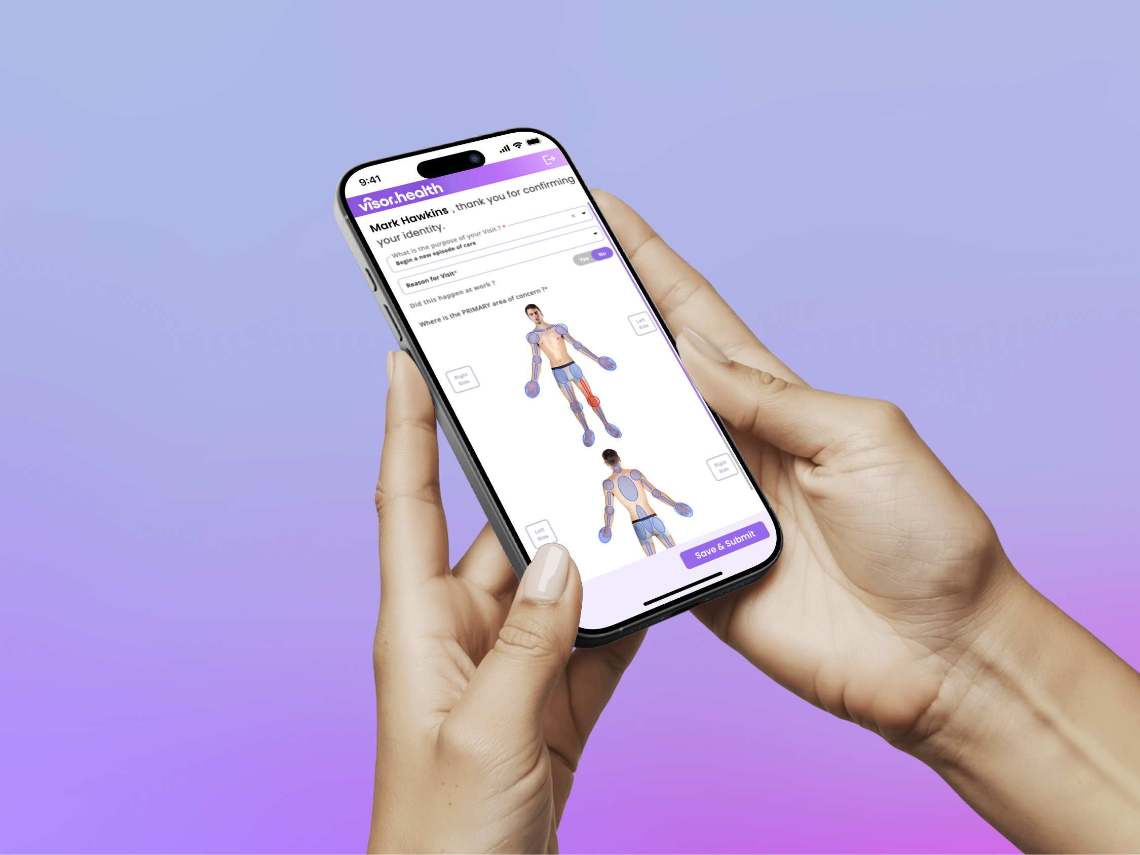 Two hands holding a smartphone displaying a health app with a body diagram highlighting the left knee in red and blue for other joints, with options to save and submit.