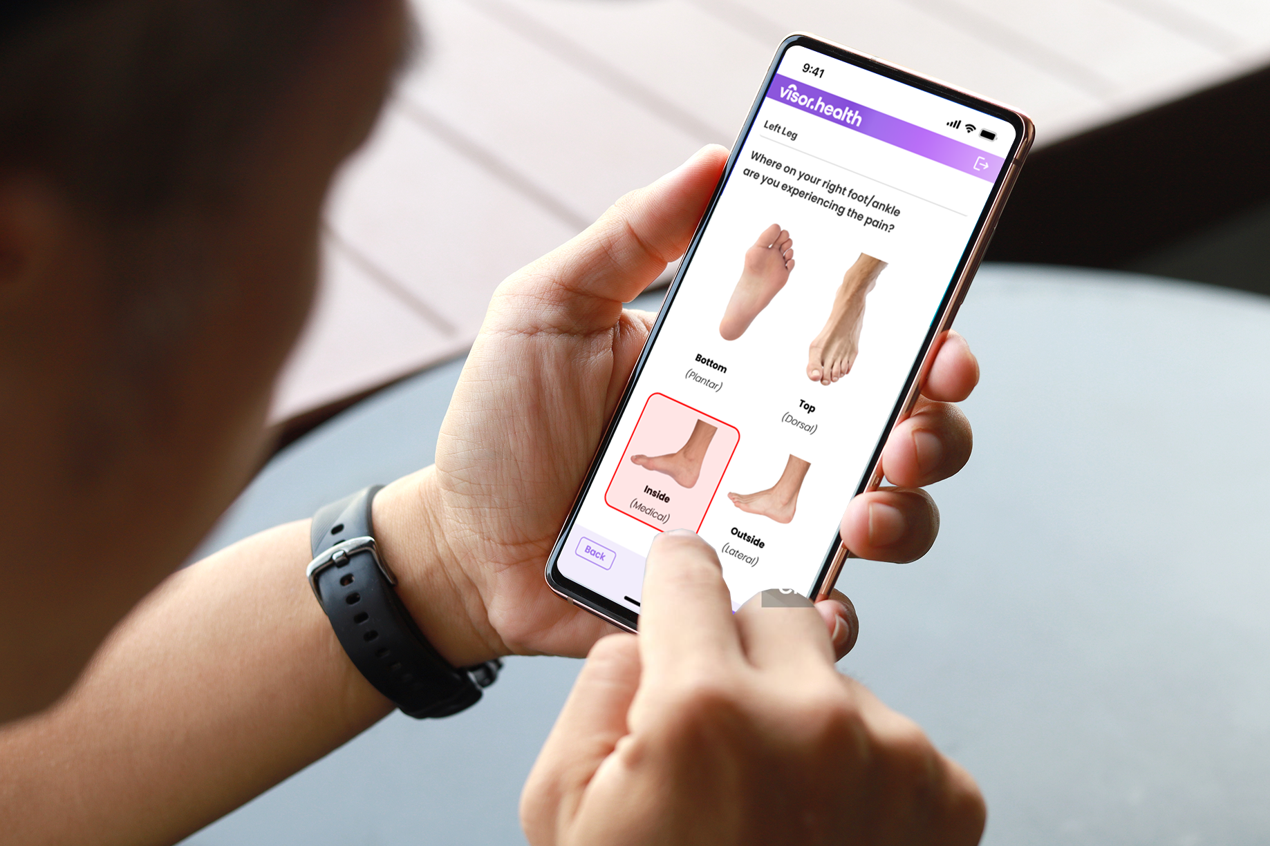 Person using a mobile app to select pain location on the inside of the right foot.