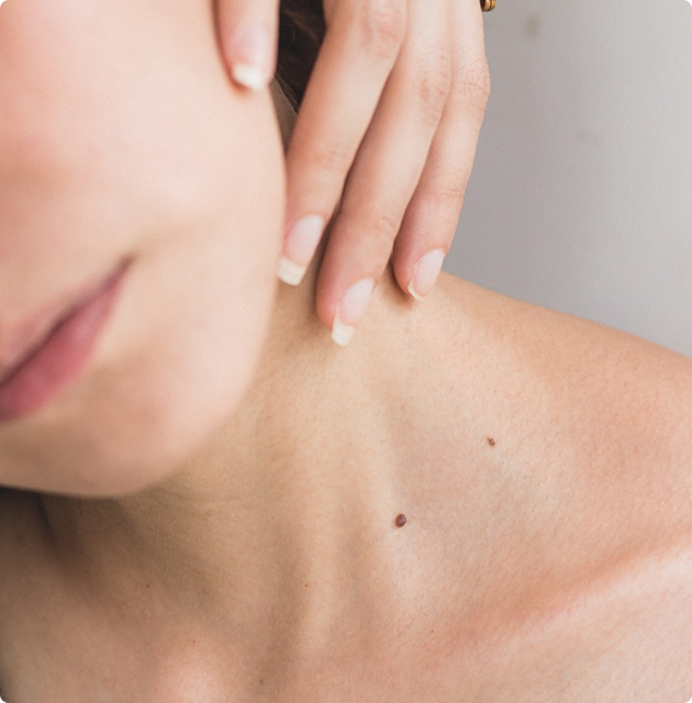 Person receiving cosmetic injection treatment