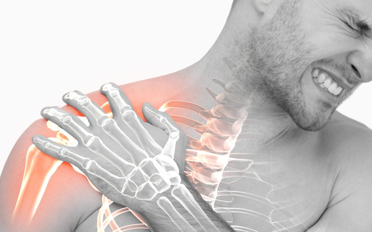 Person grimacing while holding a highlighted shoulder, with a skeletal overlay of the shoulder and upper body.