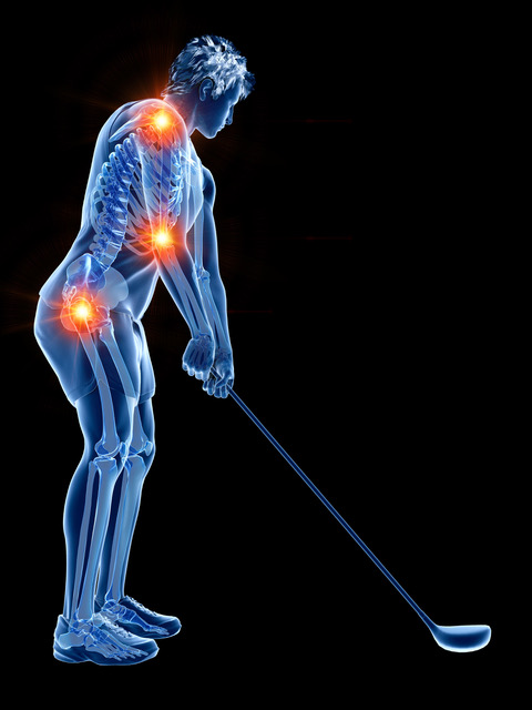 X-ray-style golfer with glowing highlights on the shoulder, elbow, and hip, holding a golf club.