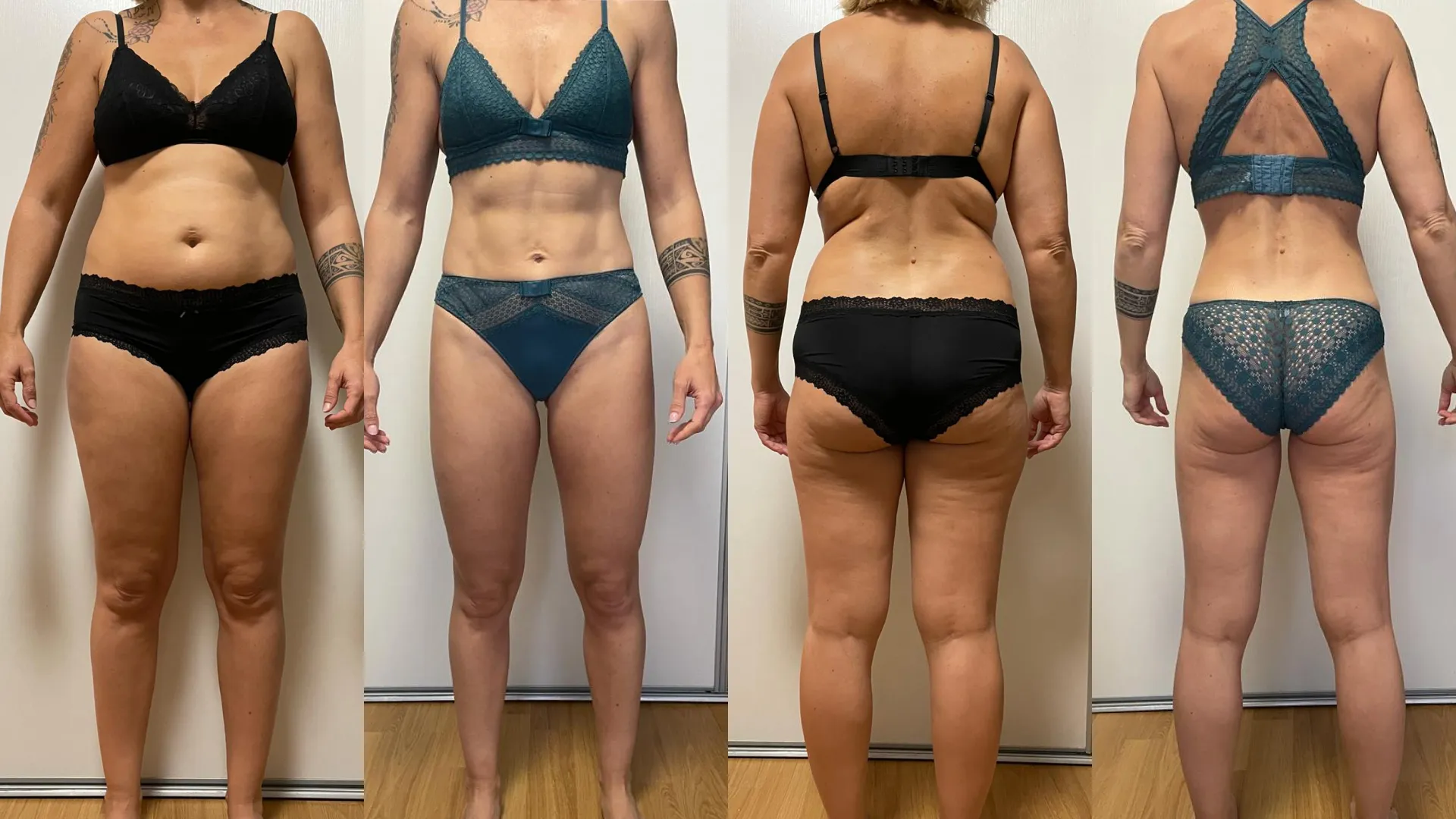 Photo avant après de Stéphanie qui a perdu plus de 10 kilos après 40 ans