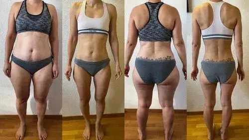 Photos of a woman before and after her body recomposition, proving that what was stored on her thighs was not excess water, but fat.
