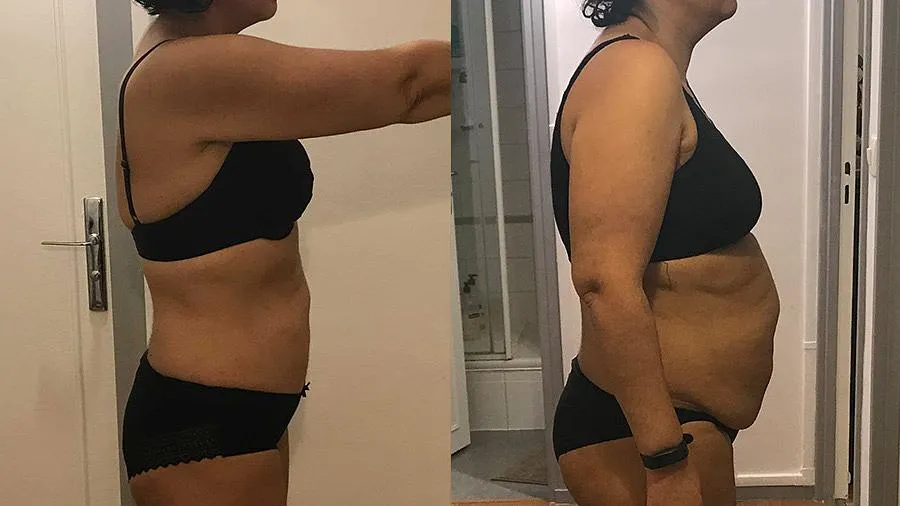 Avant-apres déficit calorique femme surpoids de 40 ans